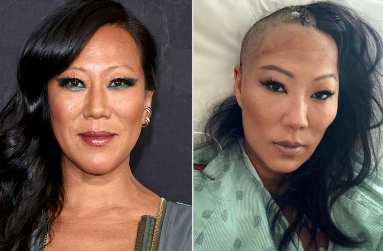 Lynn Ban Dead at 52: Tragic Loss After Emergency Brain Surgery