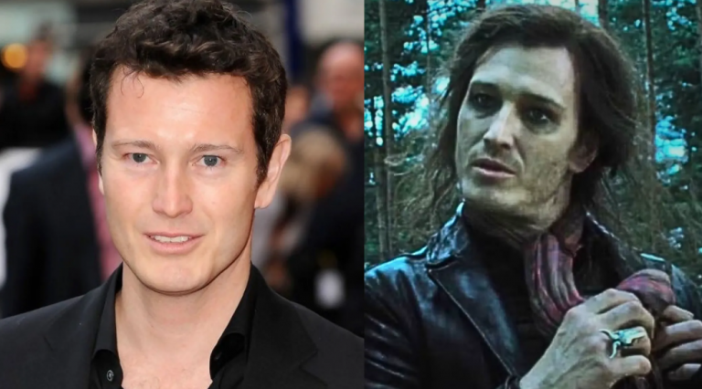 Harry Potter Actor Nick Moran Undergoes Emergency Spinal Surgery