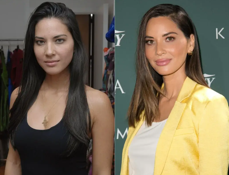 Olivia Munn Shares Health Update: Battling Breast Cancer with Strength